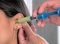 Moldagem tampão auricular